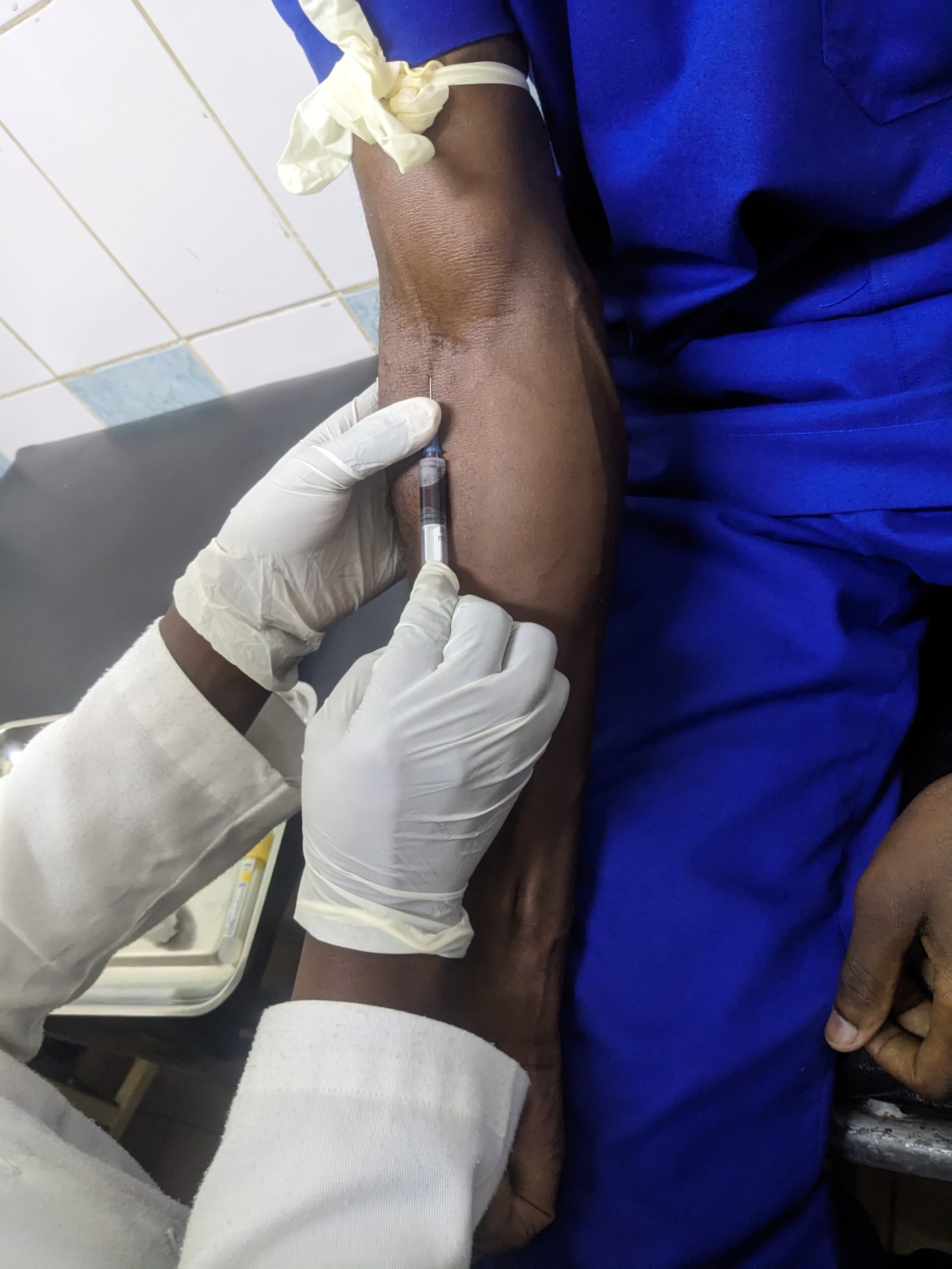 Prélèvement effectué par le personnel du Centre Hospitalier African Genesic Health (CH-AGH) chez un agent de santé dans le cadre du dépistage des hépatites B et C.